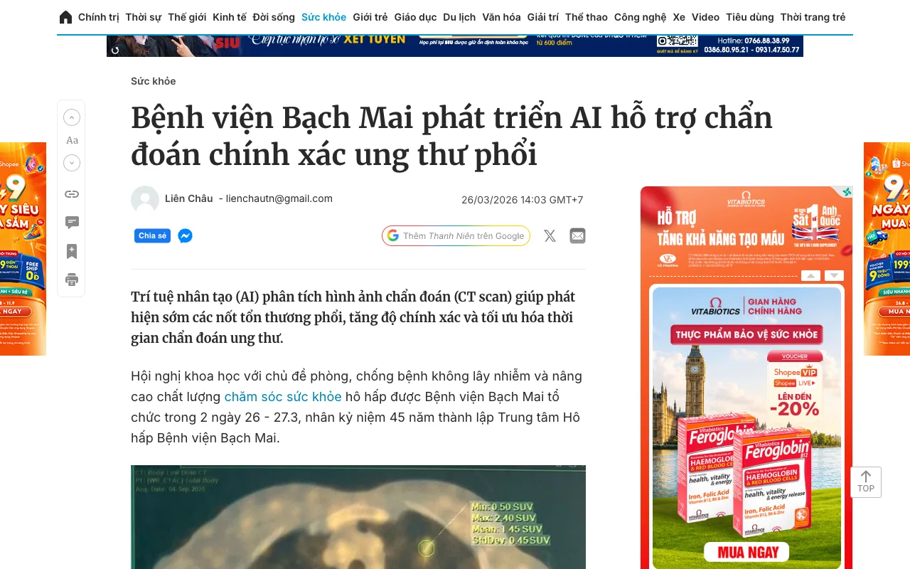 Thanh Niên : l'hôpital Bạch Mai développe une IA d'aide au diagnostic du cancer du poumon
